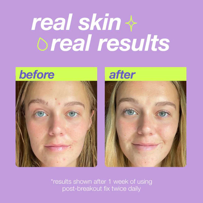 Clear Start Post breakout fix + free post and free samples