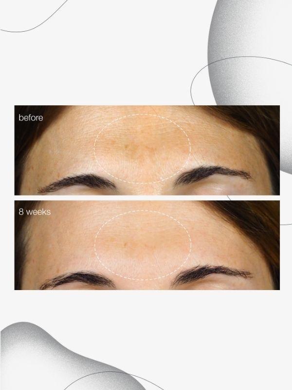 Dermalogica Powerbright Dark Spot Serum + free samples + free post